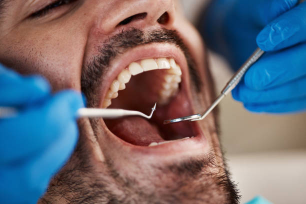 Best Pediatric Emergency Dentist in Opa Locka, FL